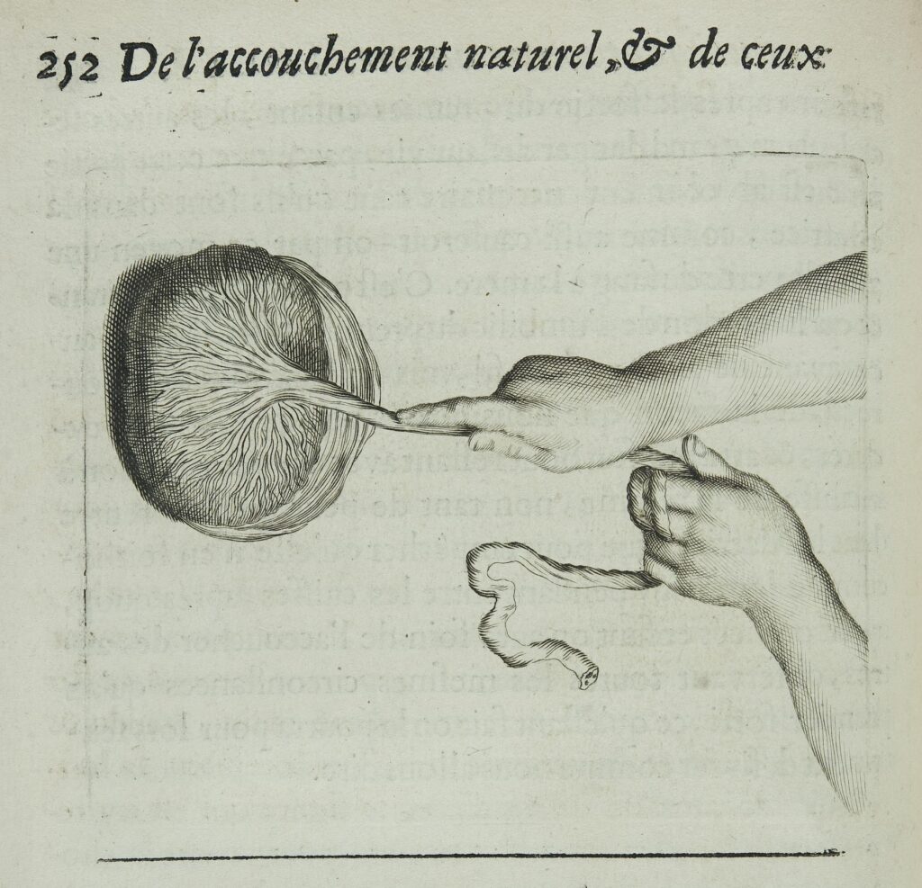 File:Illustration from Des maladies des femmes grosses Wellcome L0050602.jpg - a drawing of a hand r